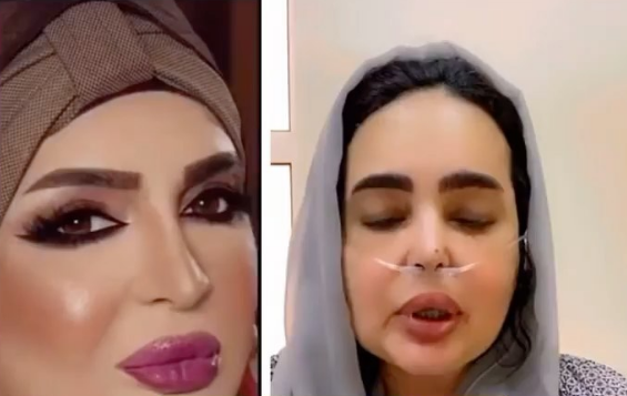 صعوبة الوضع الصحي لـ بدرية احمد 